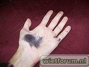 180px-Silver_nitrate_stains.jpg