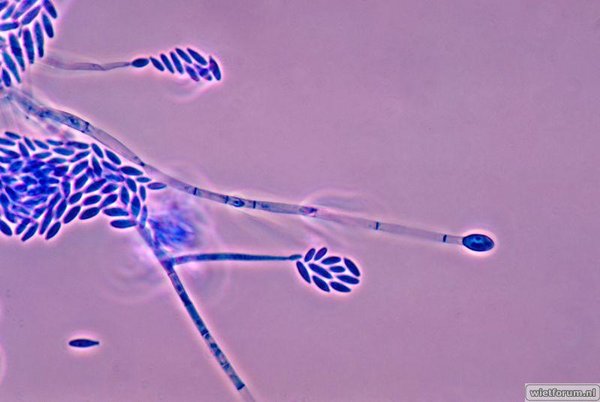 Fusarium_verticillioides_01.jpg